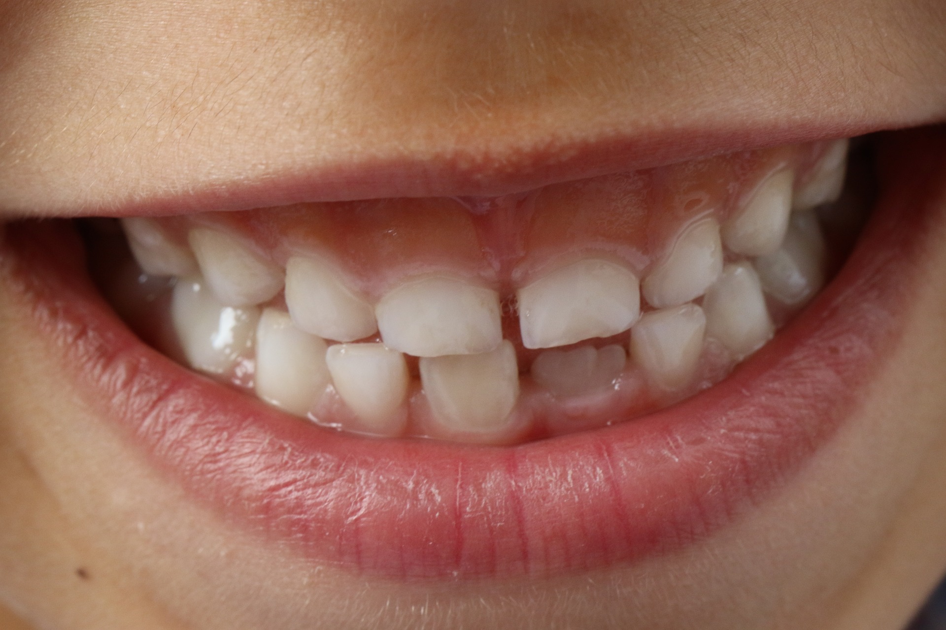 Y3/4 (A): Lesson 2: Human teeth