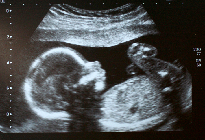 Y5/6 (B): Lesson 3: Comparing human gestation